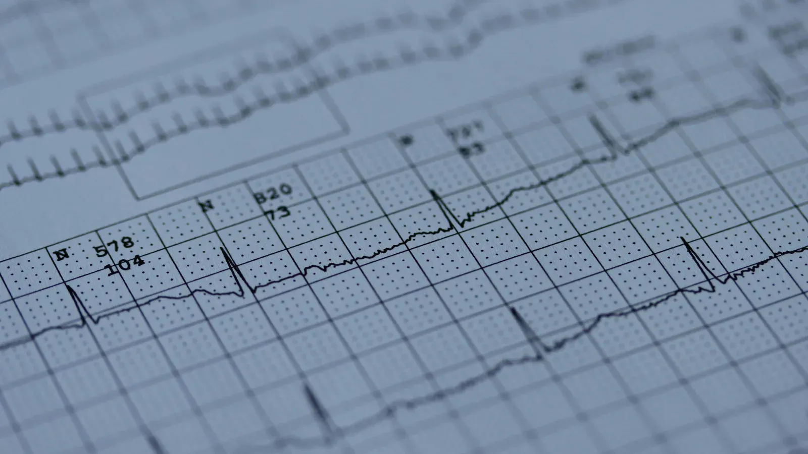 Ausschnitt einer EKG-Aufzeichnung auf Millimeterpapier