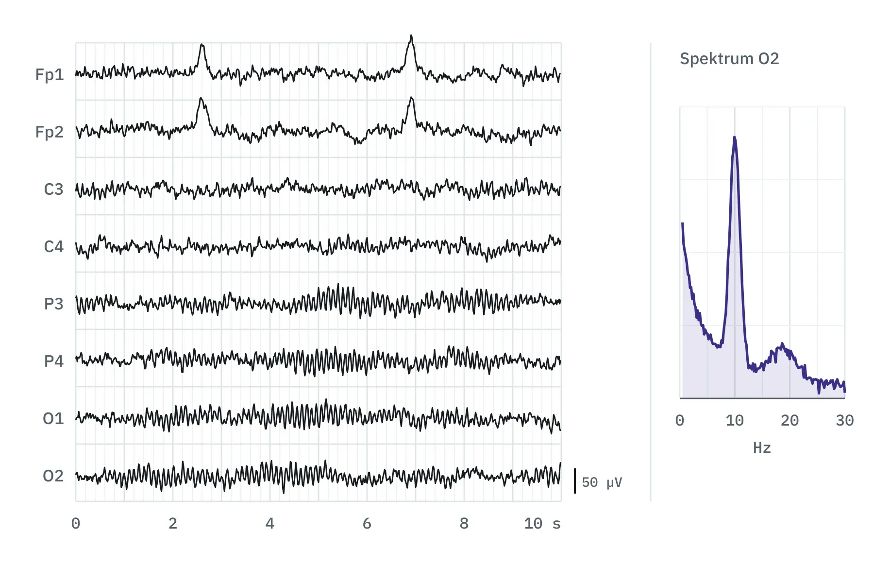 Schematische Darstellung einer EEG-Auswertung: acht EEG-Kurven über zehn Sekunden und ein Frequenzspektrum